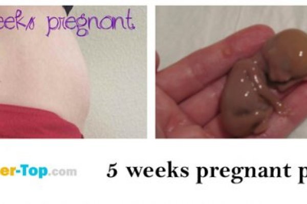 Кракен марке даркнет